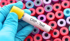 Understanding C-Reactive Protein (CRP) Tests: What You Need to Know