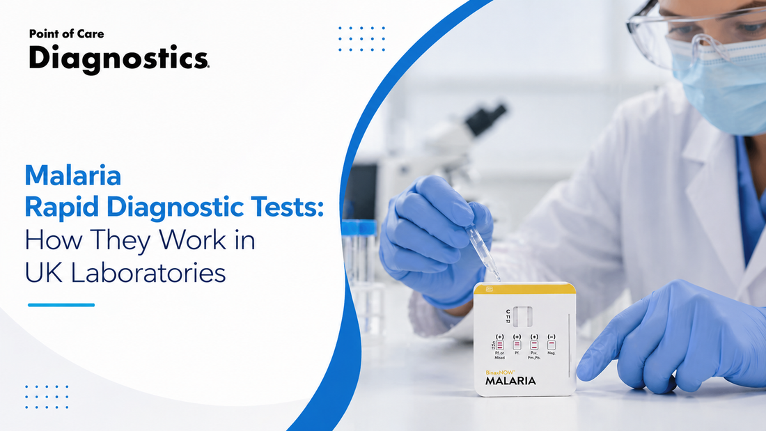 Malaria Rapid Diagnostic Tests: How They Work in UK Laboratories