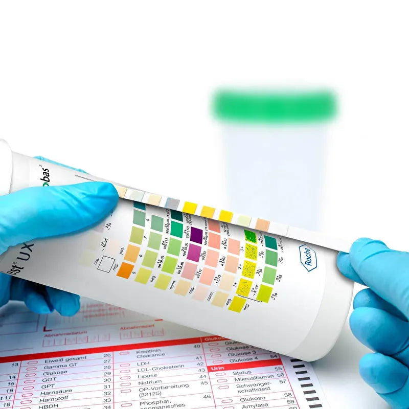 Roche Combur Test UX Strips Urisys 1100 Urinalysis Device